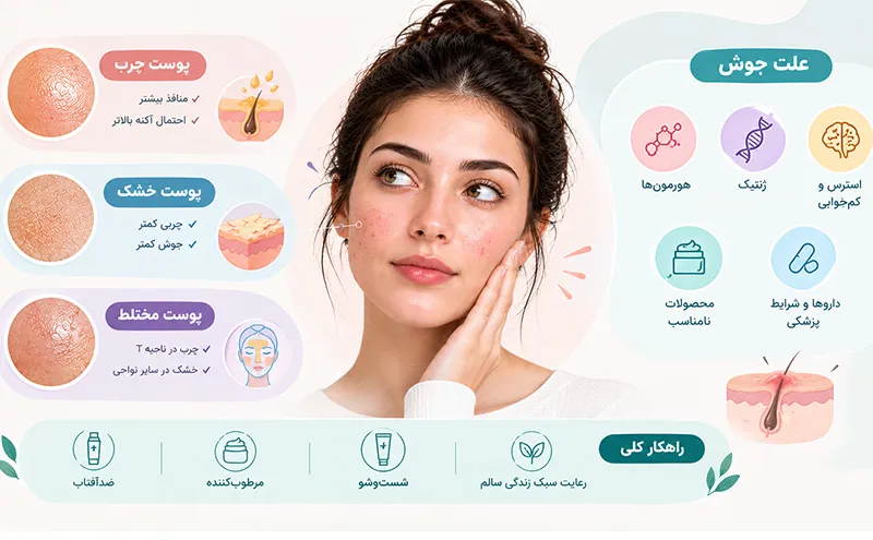 تفاوت پوست چرب و خشک در ایجاد جوش