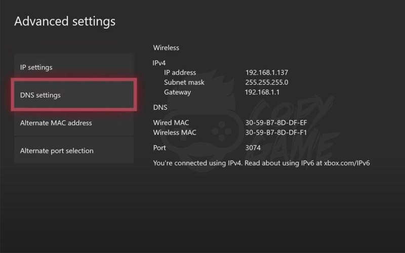 مزایای تغییر دی ان اس در ایکس باکس مزایای تغییر دی ان اس در ایکس باکس
